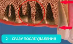 Сразу после удаления